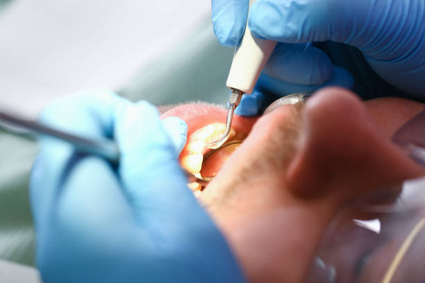 Best Broken or Chipped Tooth Repair in Lemoore, CA