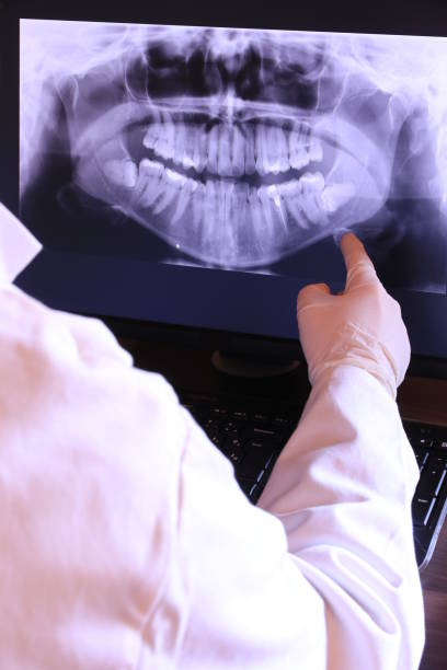 Best Emergency Care for Gum Disease in Lemoore, CA