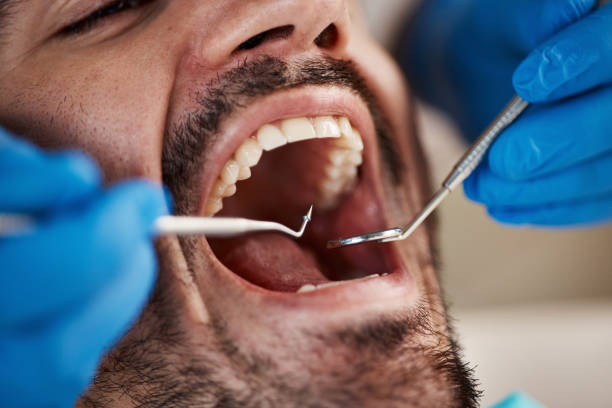 Best Broken or Chipped Tooth Repair in Lemoore, CA