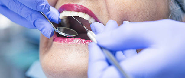 Best Emergency Wisdom Tooth Extraction in Lemoore, CA